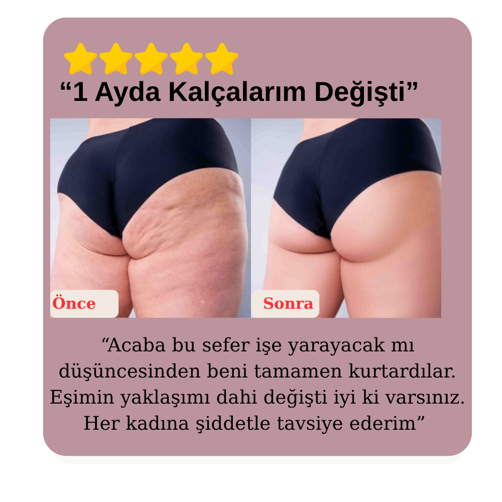 Alviera Kalça Toparlama Makesi